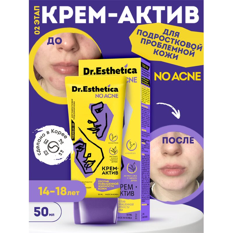 Крем-актив Dr. Esthetica no acne для кожи, склонной к акне для подростков с 14 до 18 лет туба 50 мл