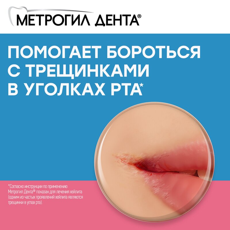 Метрогил Дента гель для десен стоматологический 20 г