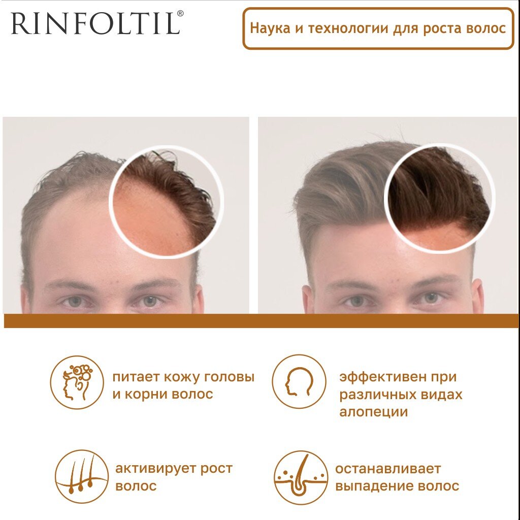 Сыворотка против выпадения волос Rinfoltil липосомальная, для предотвращения облысения у мужчин флаконы 30 шт.