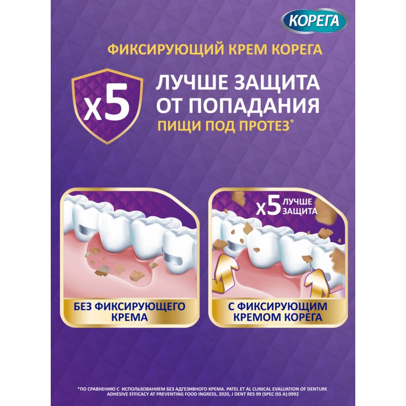 Крем для фиксации зубных протезов Корега Комплексная защита (Максимальная фиксация+прилегание) 40 г