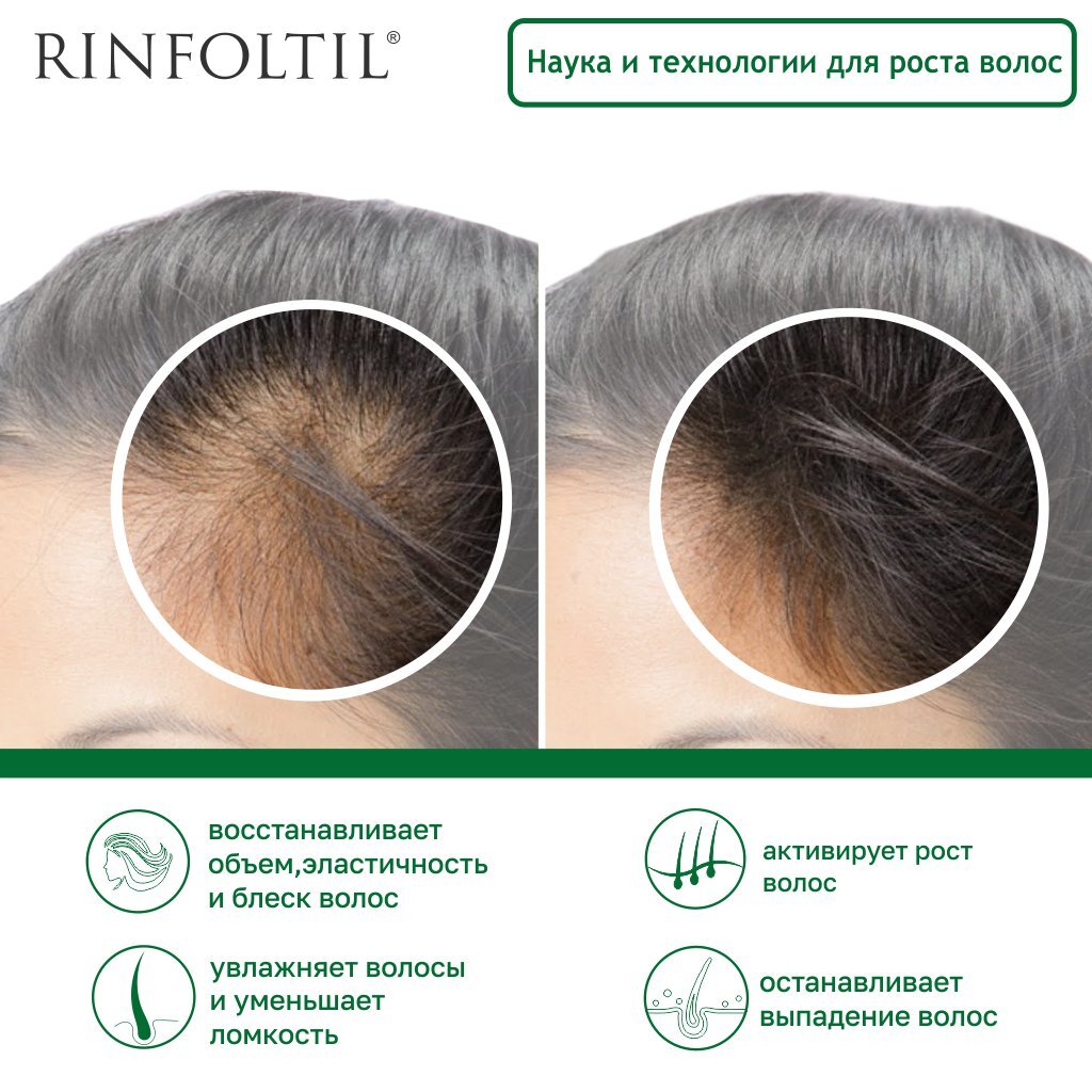 Сыворотка против выпадения волос Rinfoltil липосомальная для интенсивного роста флаконы 30 шт.