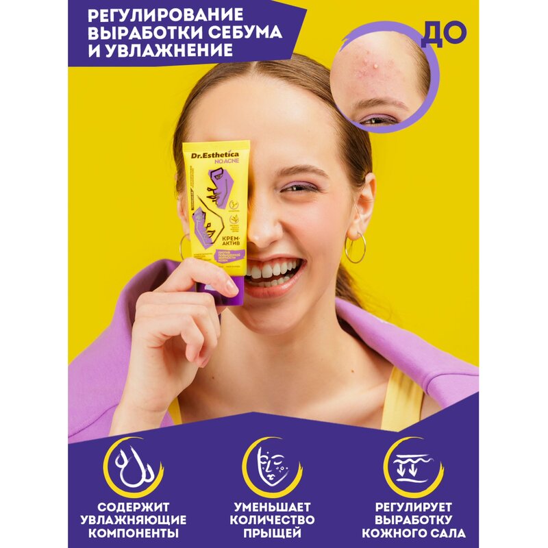 Крем-актив Dr. Esthetica no acne для кожи, склонной к акне для подростков с 14 до 18 лет туба 50 мл