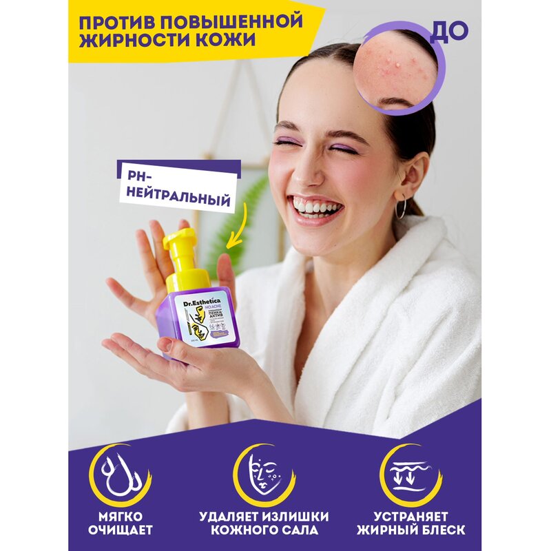 Пенка-актив Dr. Esthetica no acne для подростков 14-18 лет очищающая для жирной кожи, склонной к акне 20 мл