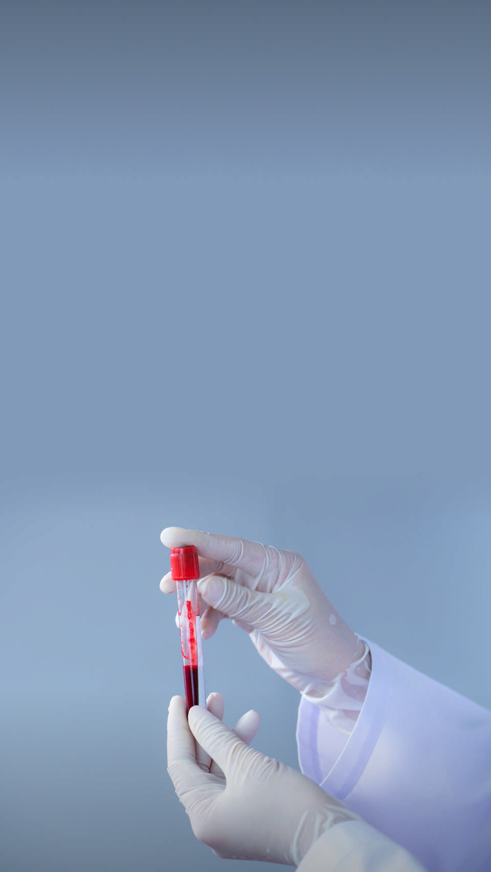 Зачем мужчинам сдавать кровь на ПСА? Читать 👉