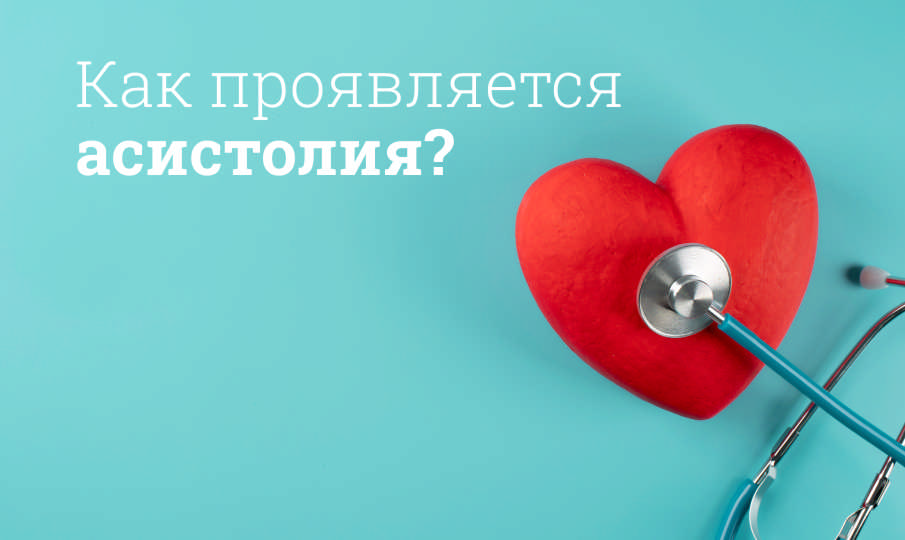 Что такое асистолия?