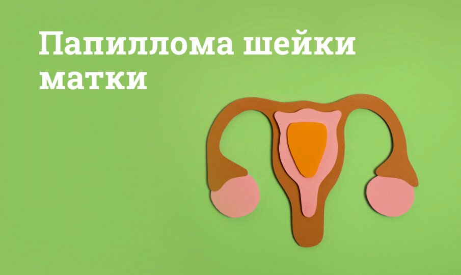 Папиллома шейки матки: лечение и симптомы