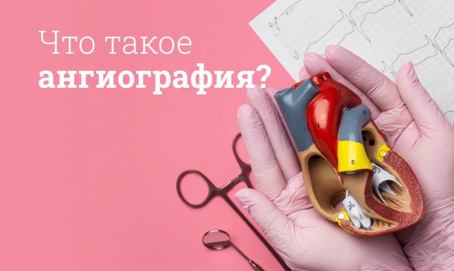 Что такое ангиография?