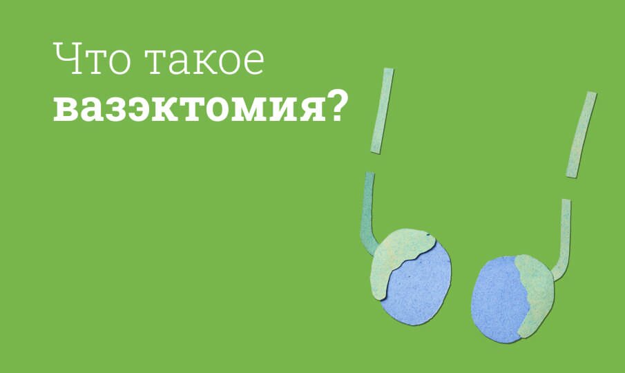 Что такое вазэктомия?