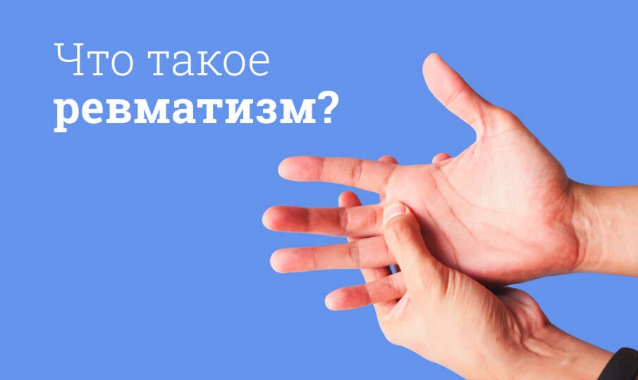 Симптомы и лечение ревматизма