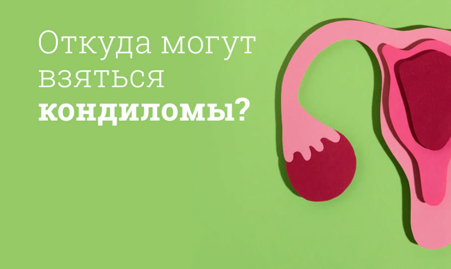 Лечение кондиломы