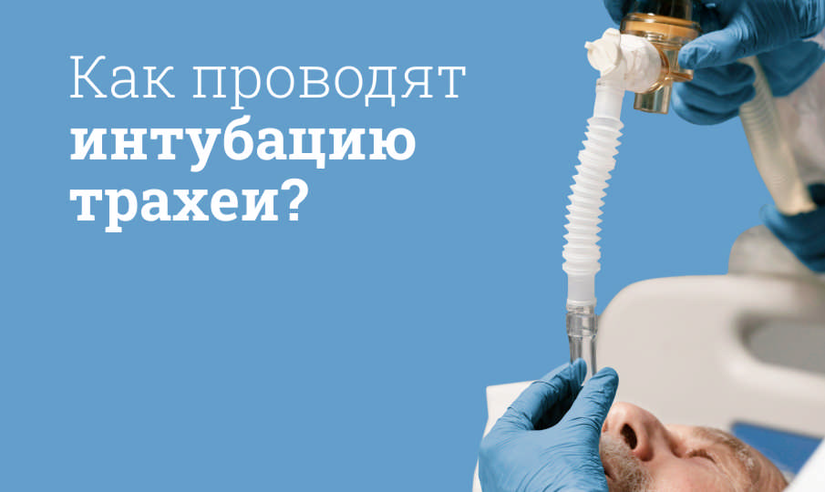 Интубация трахеи