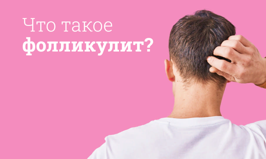 Что такое фолликулит?