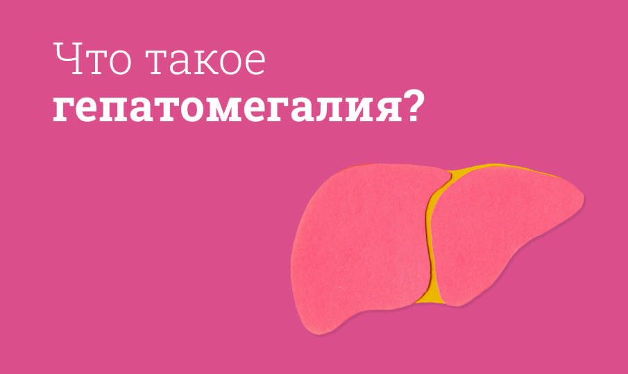 Гепатомегалия: лечение и симптомы