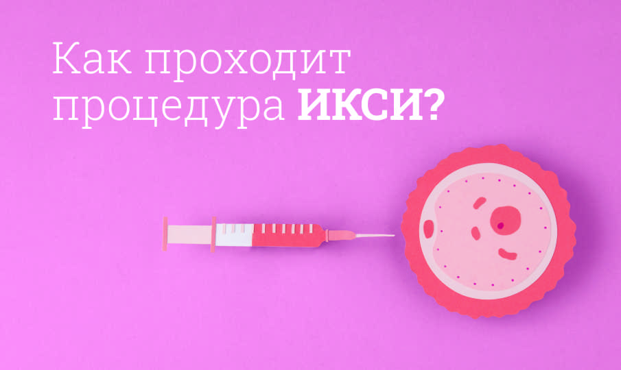 Что такое ИКСИ?