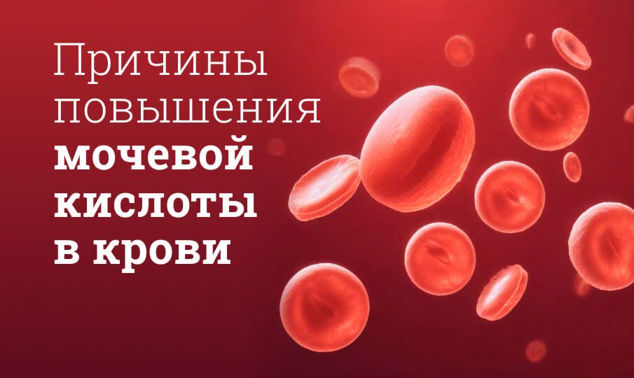 Какие продукты снижают мочевую кислоту в организме?