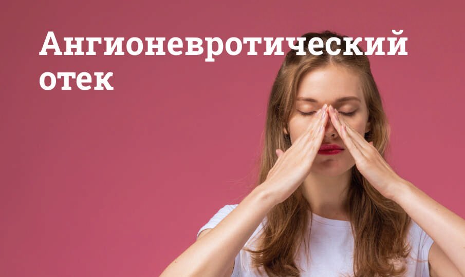 Симптомы и лечение ангионевротического отека