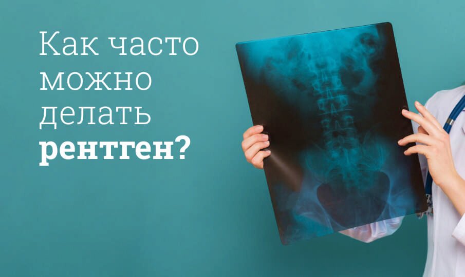 Как часто можно делать рентген?