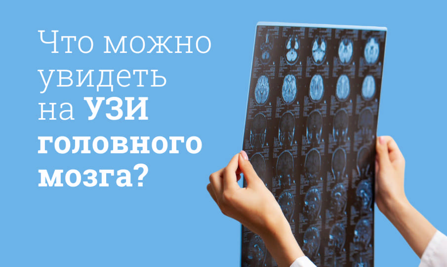 УЗИ головного мозга