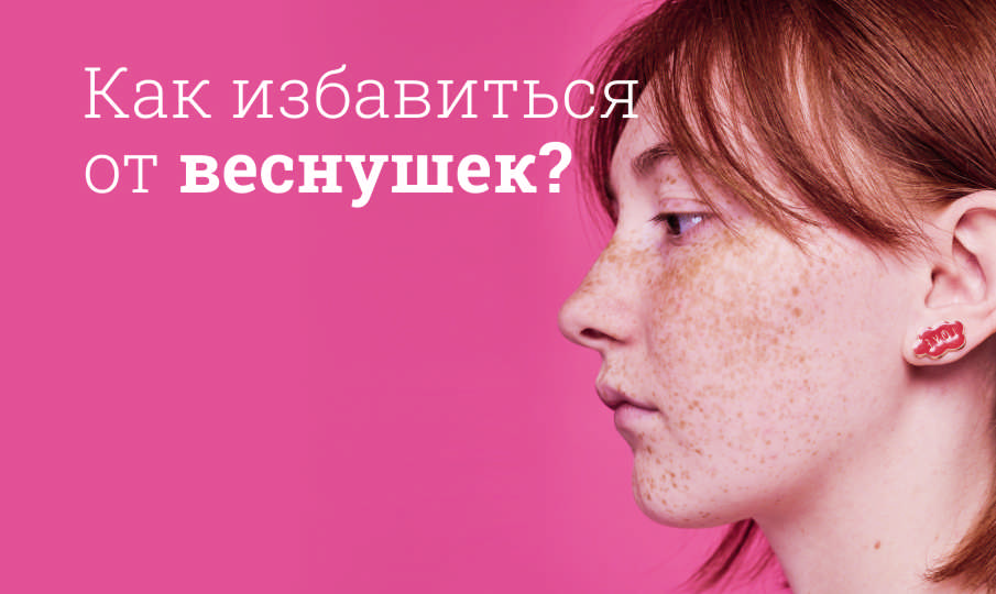 Как избавиться от веснушек?