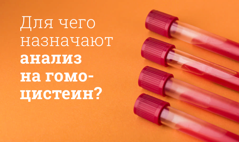 Для чего назначают анализ на гомоцистеин?