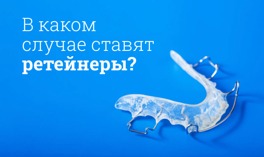 Что такое ретейнеры?