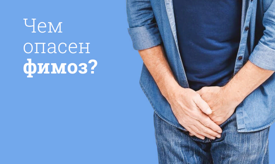 Что такое фимоз?