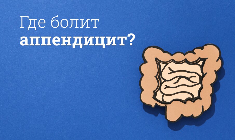 Где болит аппендицит?