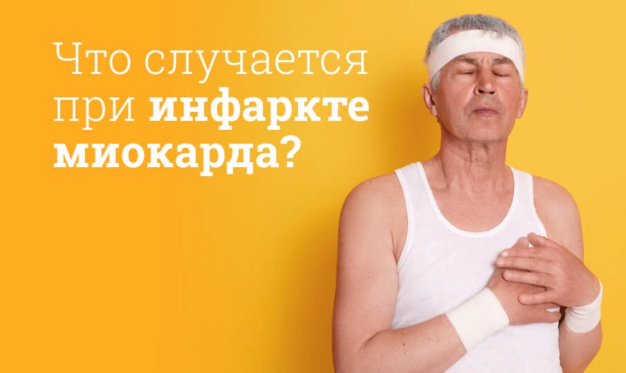 Симптомы инфаркта миокарда