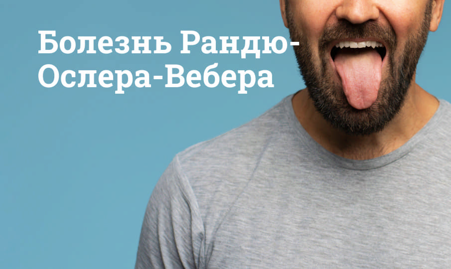Болезнь Рандю-Ослера-Вебера