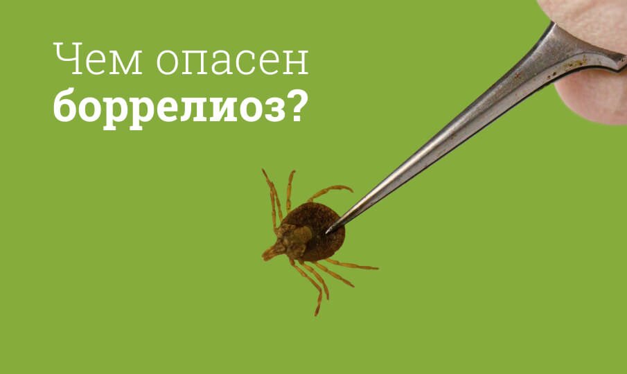 Боррелиоз: симптомы и лечение