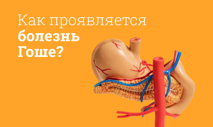 Болезнь Гоше