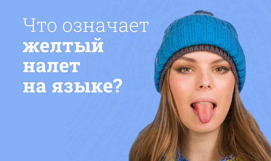 Желтый налет на языке: что делать