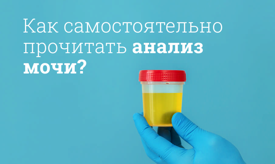 Как прочитать анализ мочи общий самостоятельно?