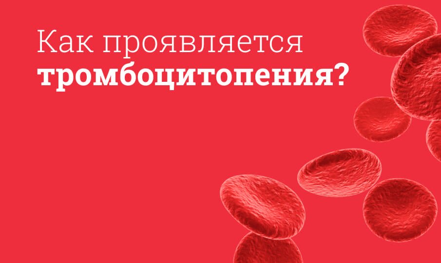 Тромбоцитопения: причины и лечение