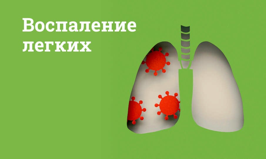 Симптомы и лечение воспаления легких