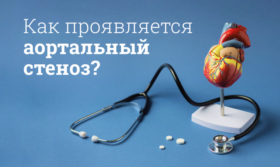 Что такое аортальный стеноз?