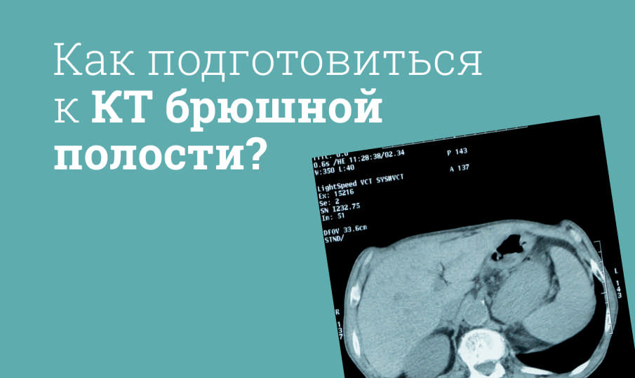 КТ брюшной полости с контрастом