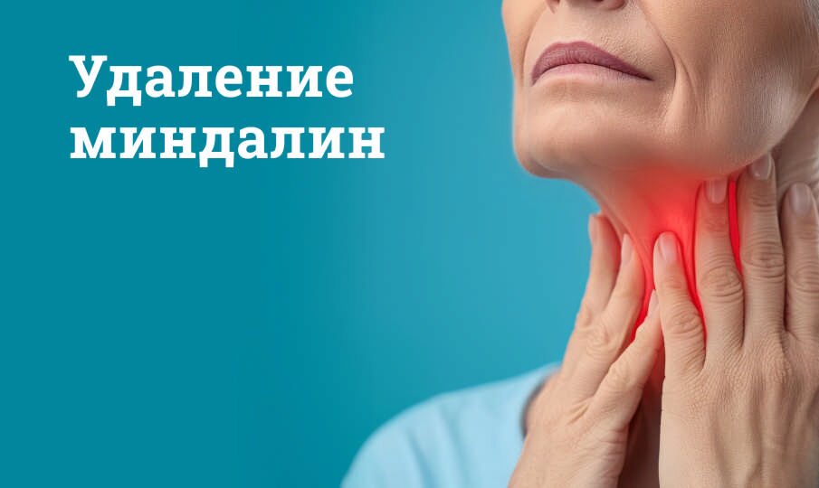 Операция по удалению миндалин