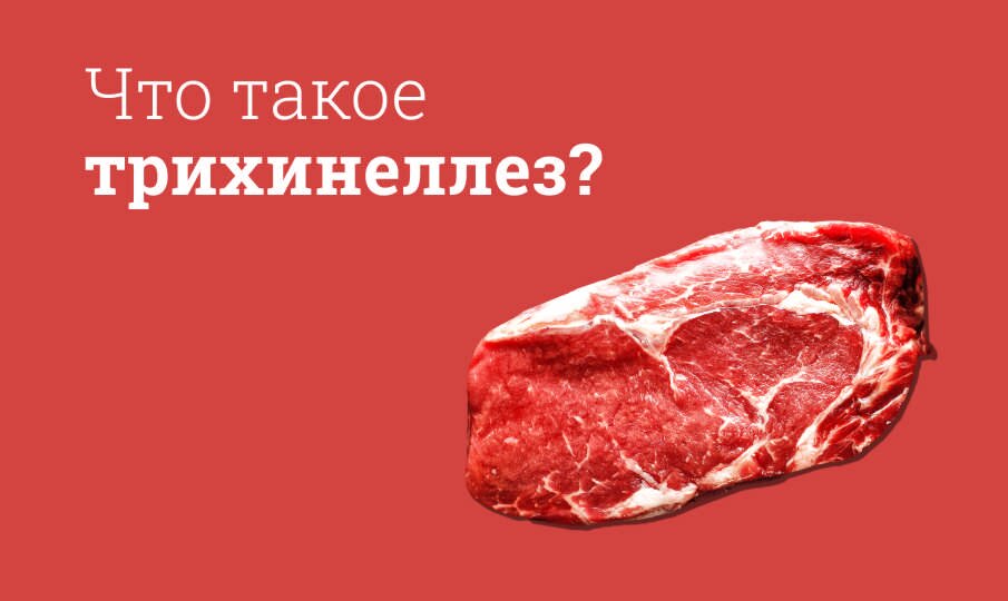 Что такое трихинеллез?