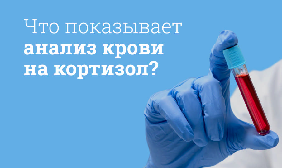Анализ на кортизол
