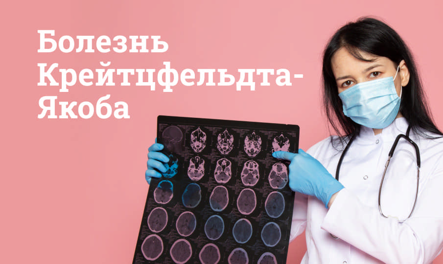 Болезнь Крейтцфельдта-Якоба