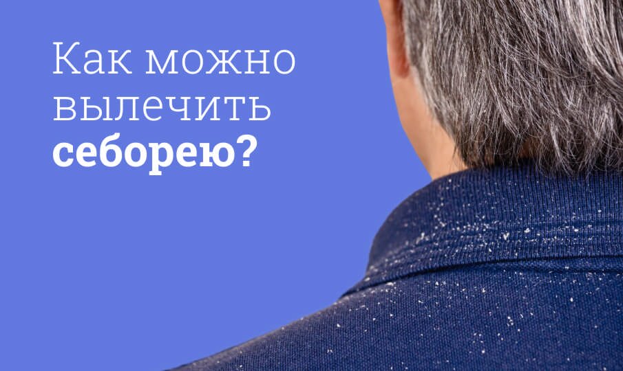 Себорея: причины и лечение