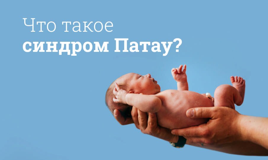 Синдром Патау: симптомы и лечение