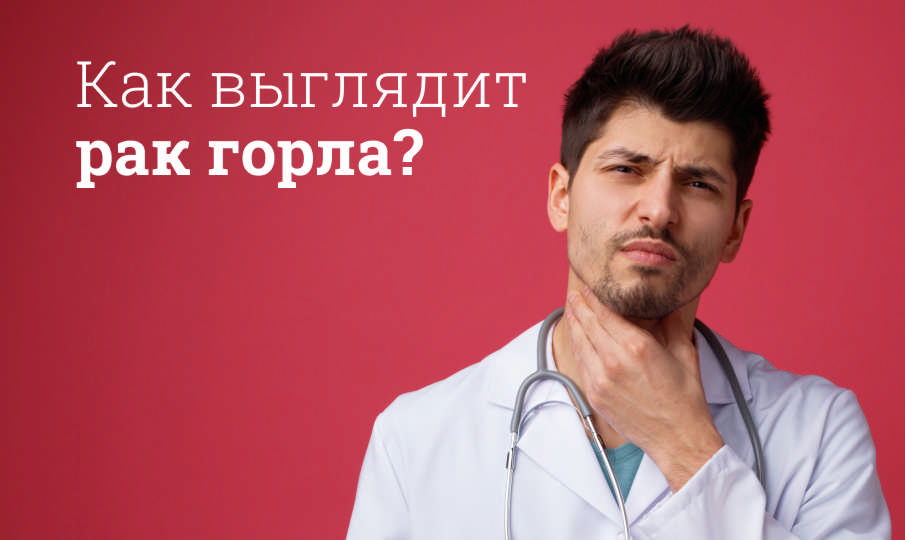 Как выглядит рак горла?