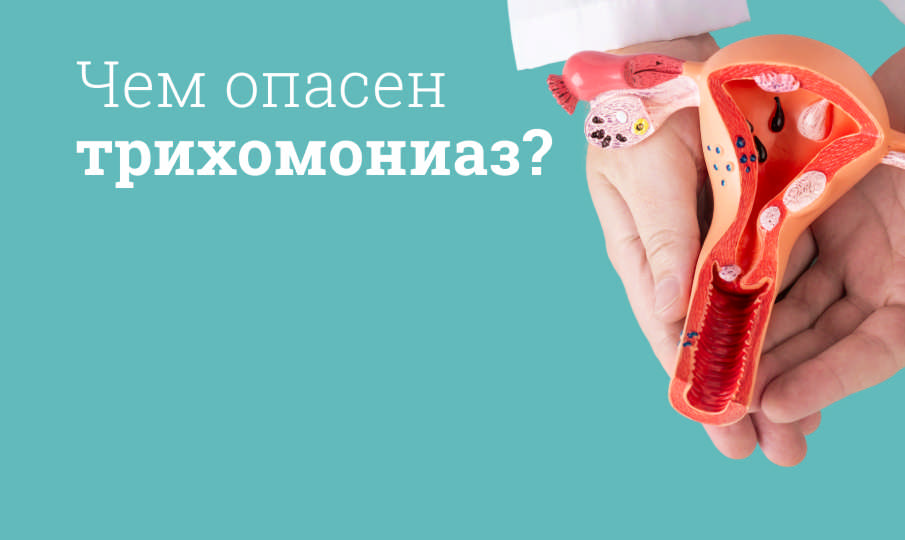 Лечение трихомониаза