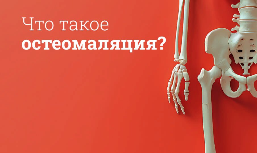 Остеомаляция: симптомы и лечение
