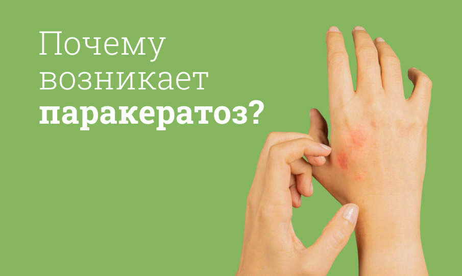 Что такое паракератоз?