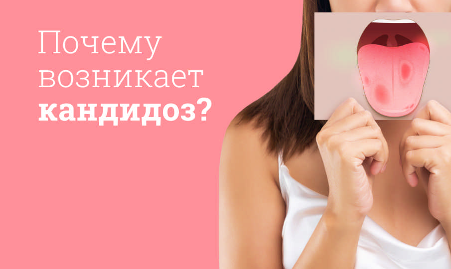 Кандидоз полости рта и кишечника