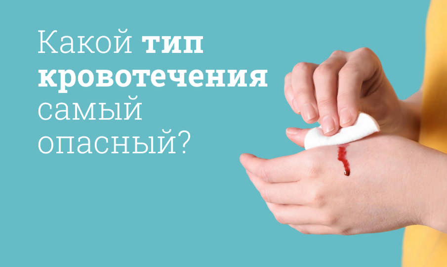 Виды кровотечений