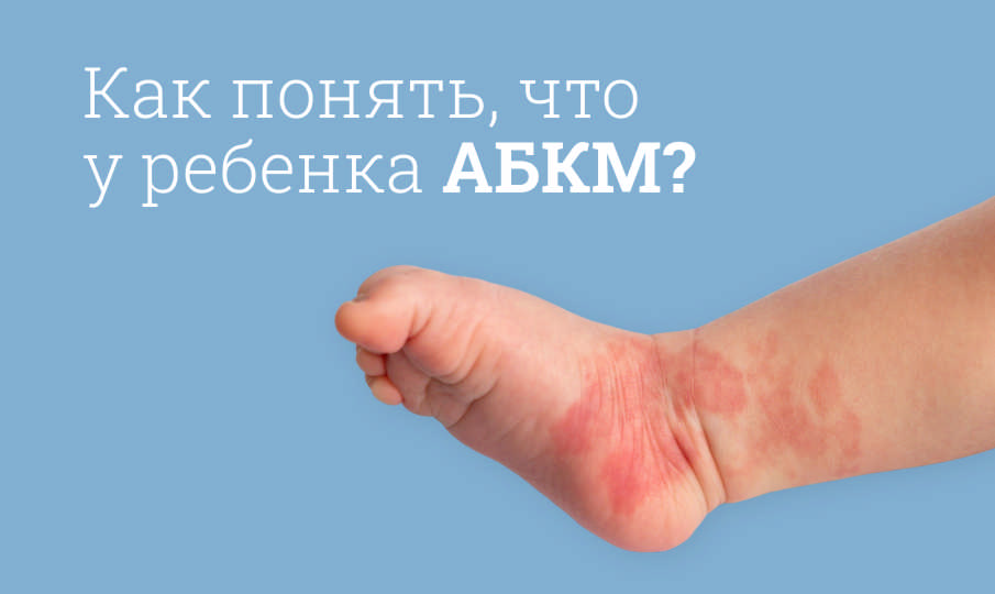Что такое АБКМ?
